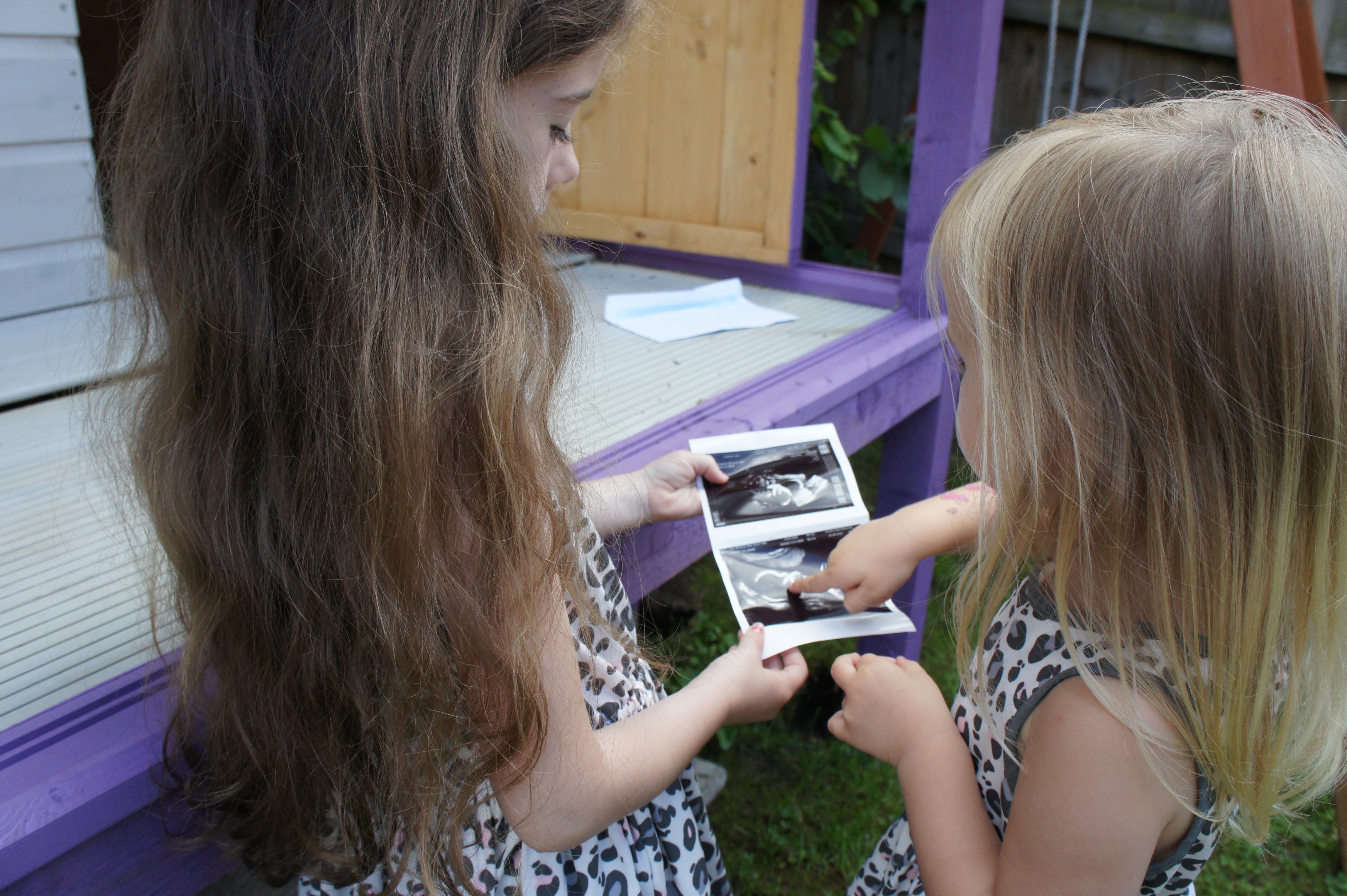 20 week scan